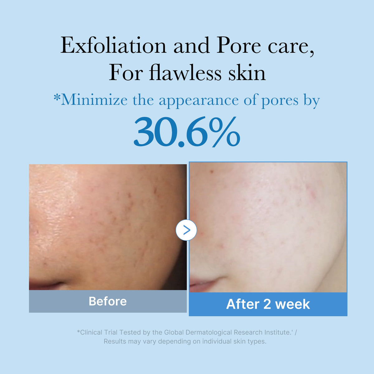 zero-pore-toner-k7 01_d6480b4e-3c08-4954-994a-ed5212c1839c.jpg