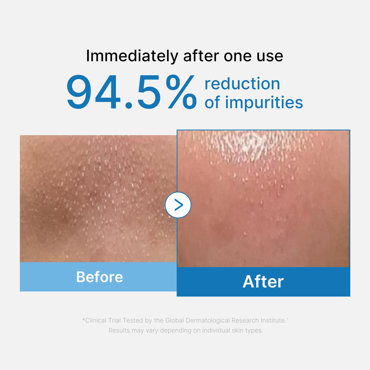 zero-pore-blackhead-deep-cleansing-oil-q7 01_eed557ec-5857-46a2-8b17-dbd67c692dcb.jpg