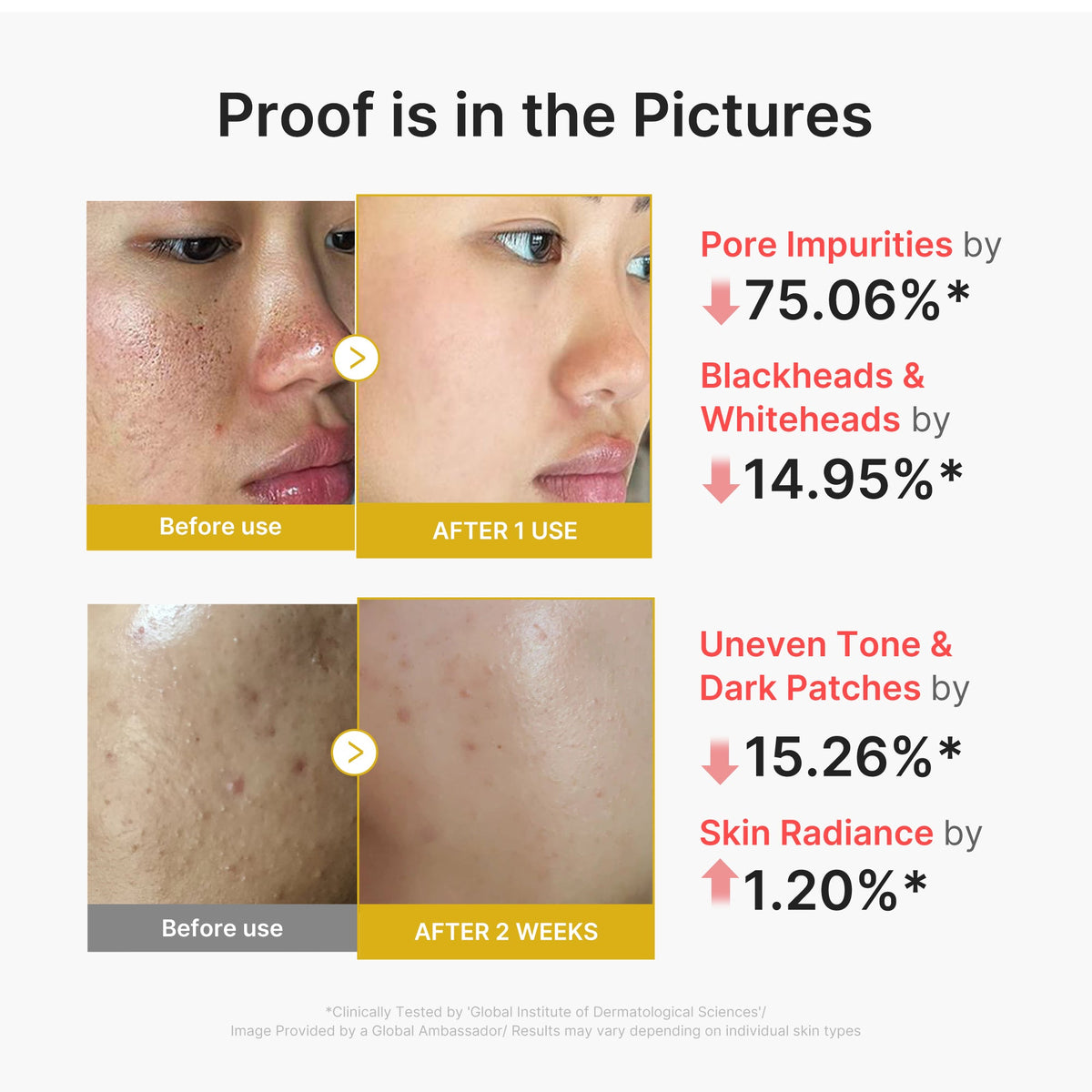 kojic-acid-turmeric-peel-shot-f1 02_45fe66d3-b3f6-4100-aa52-2afd7eded417.jpg