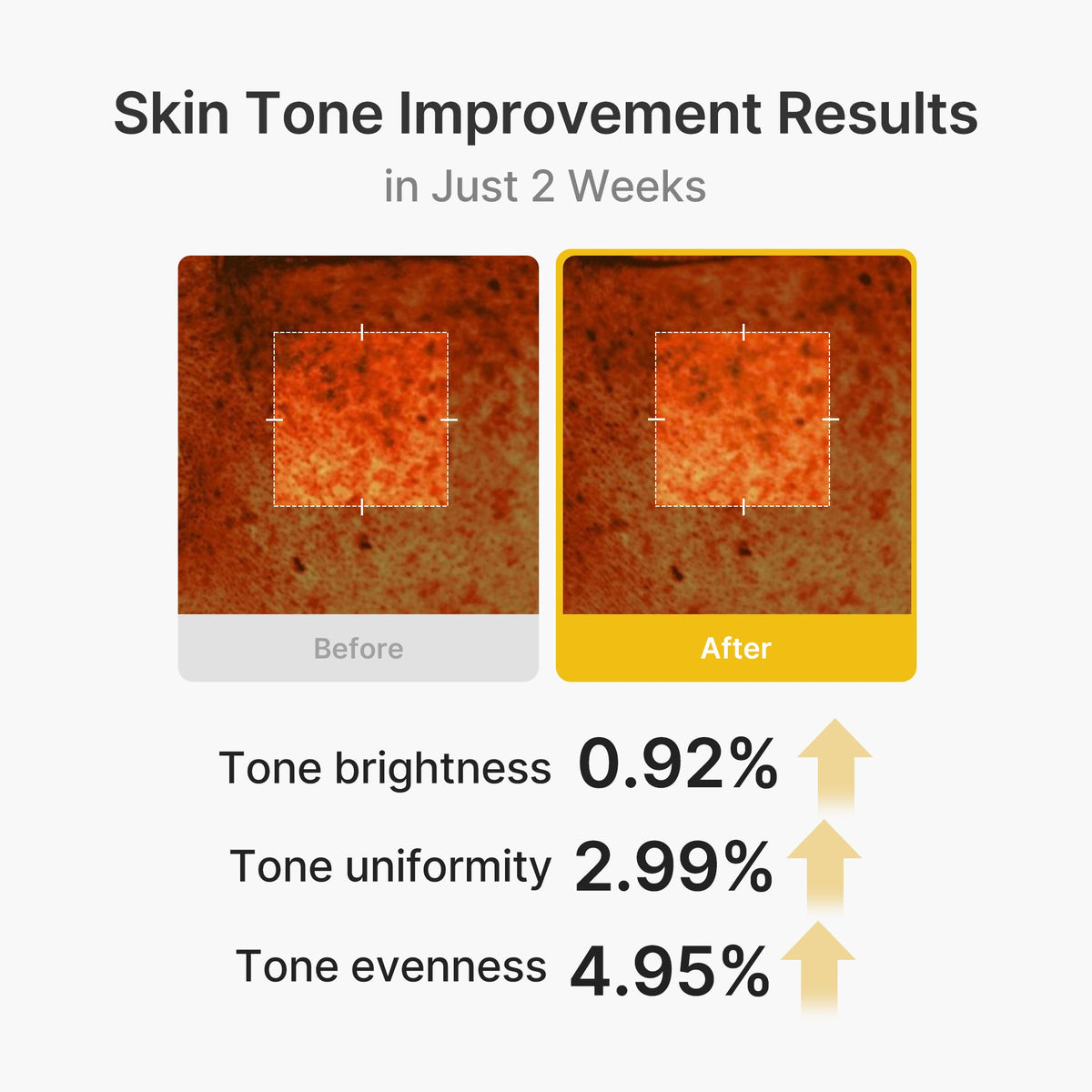 kojic-acid-turmeric-vita-capsule-cream-g5 03_2b626701-fc6c-4702-9e96-a2157a4f7f9d.jpg