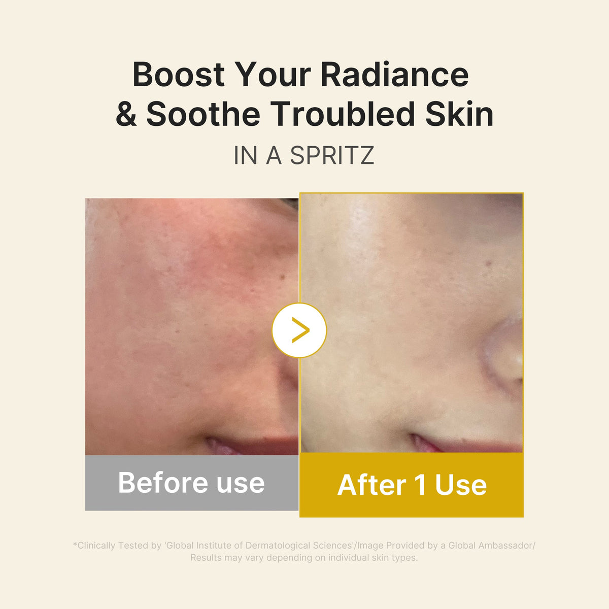 kojic-acid-turmeric-vitamin-gold-jelly-mist-serum-h8 03_dc9cd19e-4e57-49d3-9b66-c7762e8a63f1.jpg