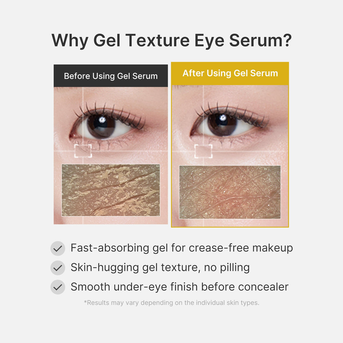 kojic-acid-tumeric-eye-gel-serum-c4 04_0487ef36-49f4-4294-8049-bb55118b05fe.jpg