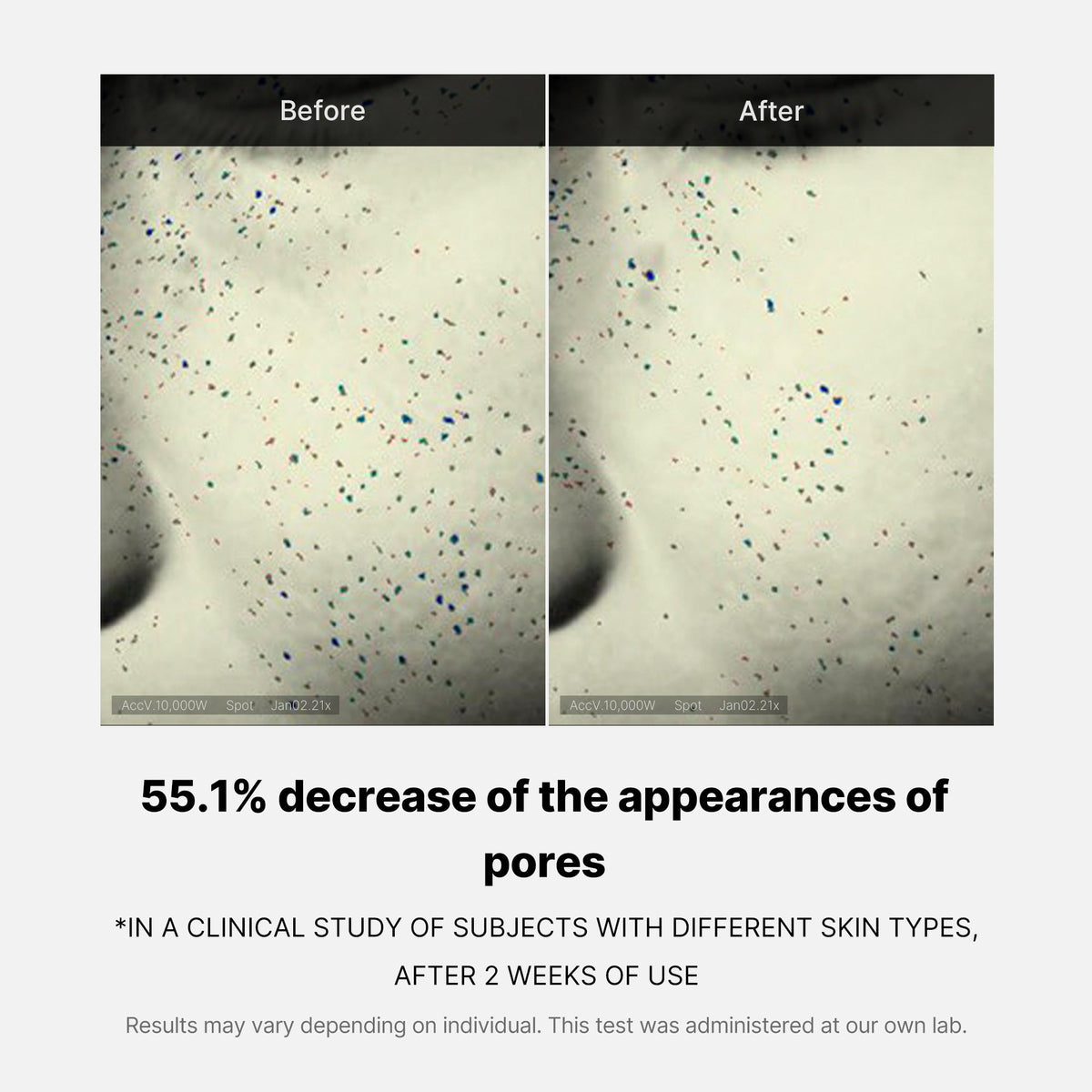 pore-care-duo-j5 05_12ddab8a-64be-4612-8ee1-27e5ec701921.jpg