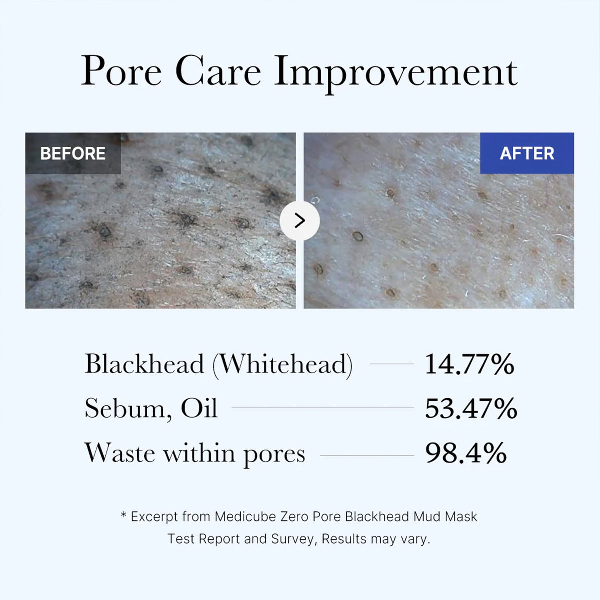 zero-pore-blackhead-mud-mask-a6 05_9362a158-c2b3-4525-acc0-631a2cfdea47.jpg