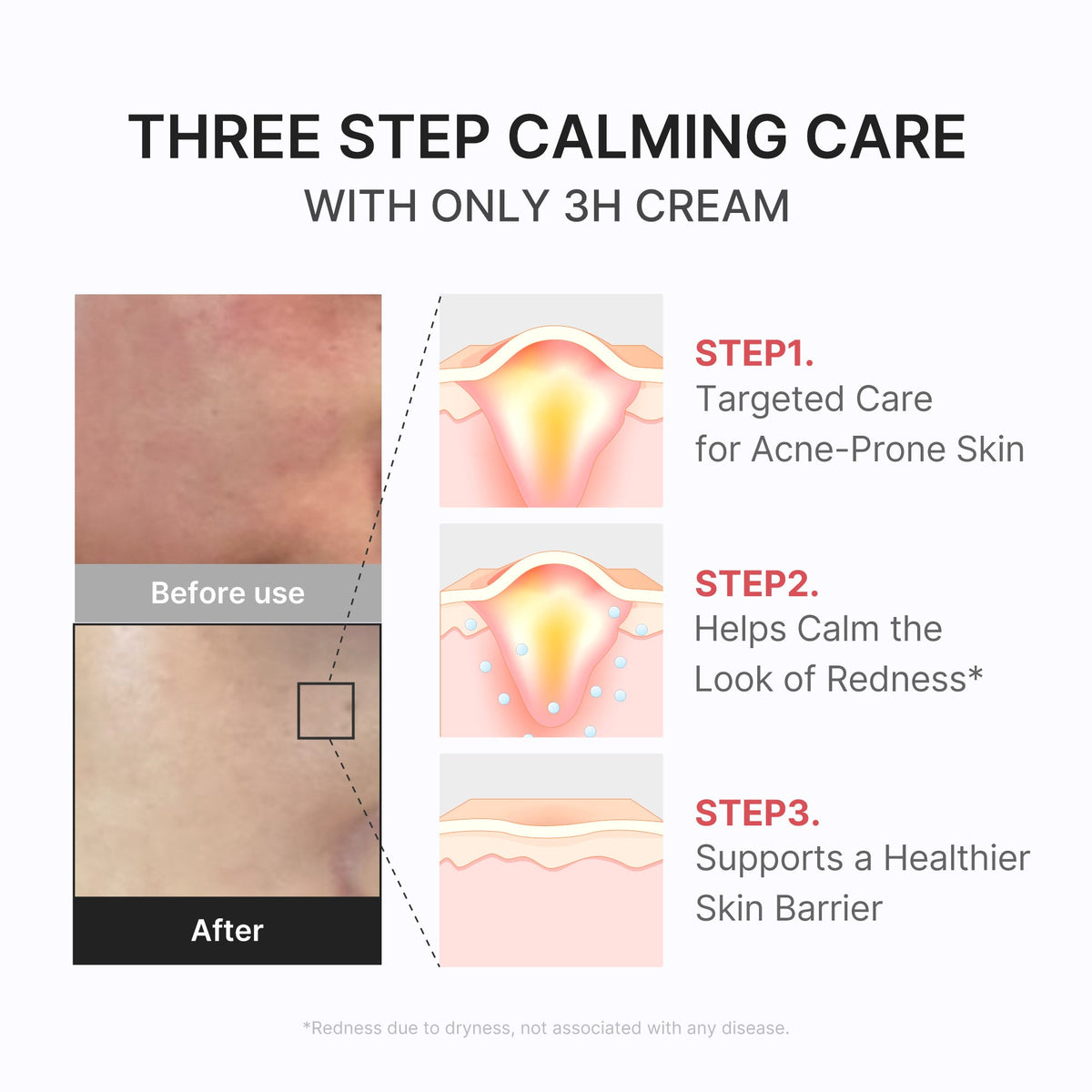 3h-daily-relief-cream-s1 3H_04.jpg