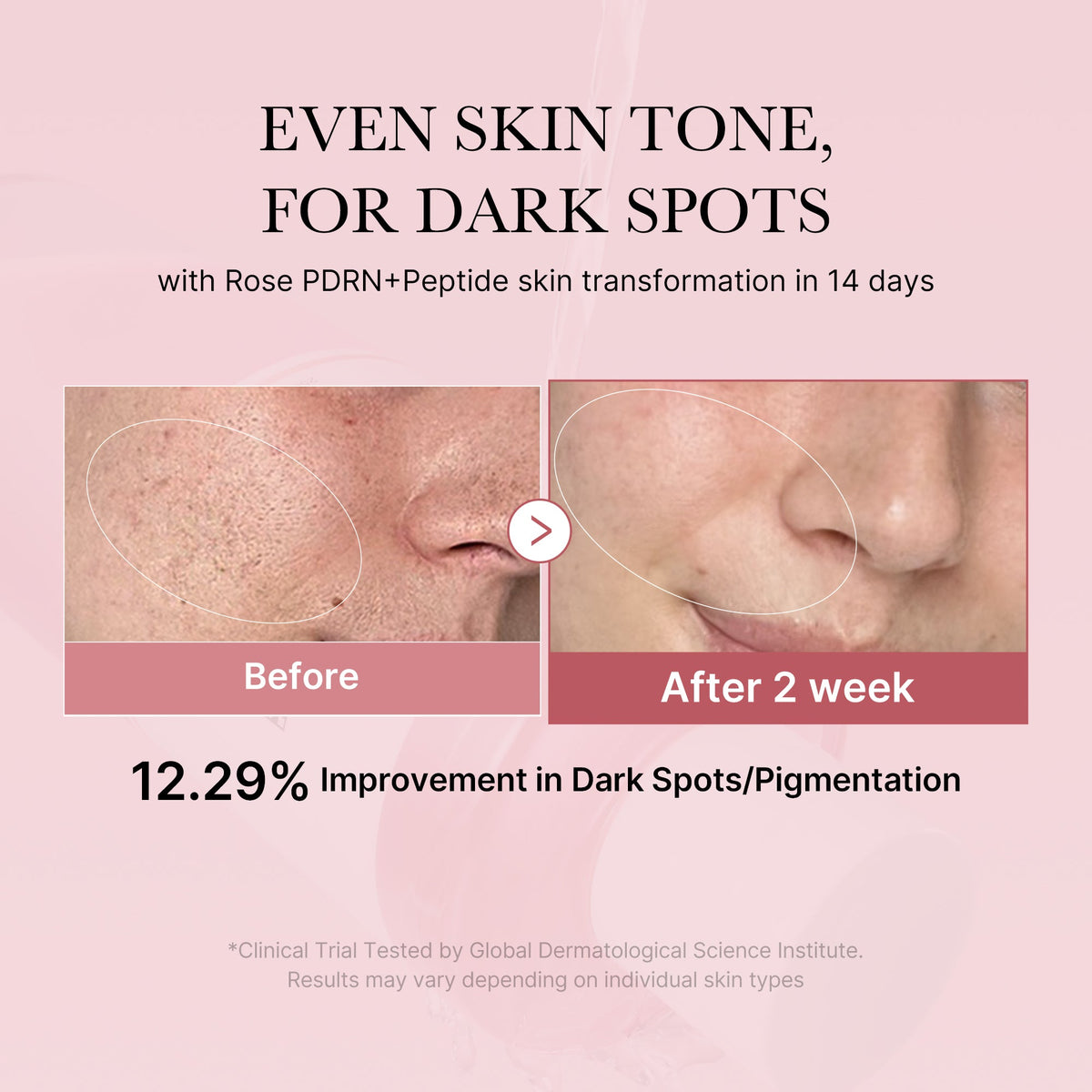 pdrn-pink-peptide-toner-b0 PDRN_01_308c518e-5ac6-4e54-99bd-eabc8796739b.jpg