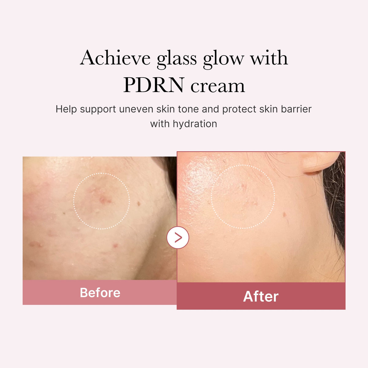 pdrn-pink-peptide-cream-v3 PDRN_02_d7805bfe-cf43-446a-b71b-a276683f136b.jpg