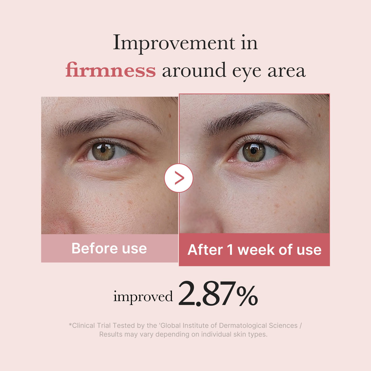 pdrn-pink-peptide-eye-cream-a8 PDRN_03_256dd753-0a2f-41b4-b3cd-bbfd3bc27018.jpg