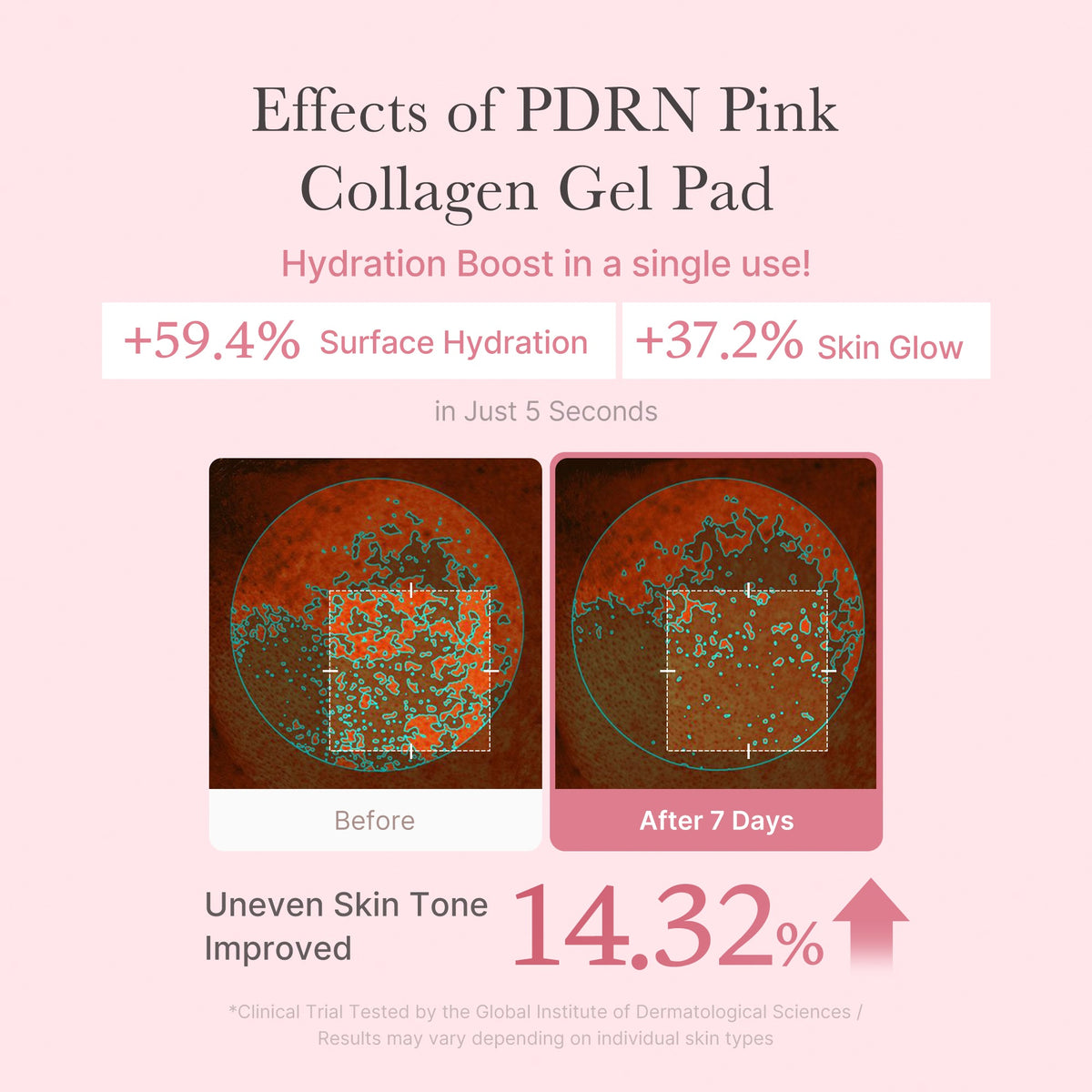 pdrn-pink-collagen-gel-toner-pad-t8 PDRN_04_f9a16a56-8d9e-4c47-a635-ed34ec3ed571.jpg