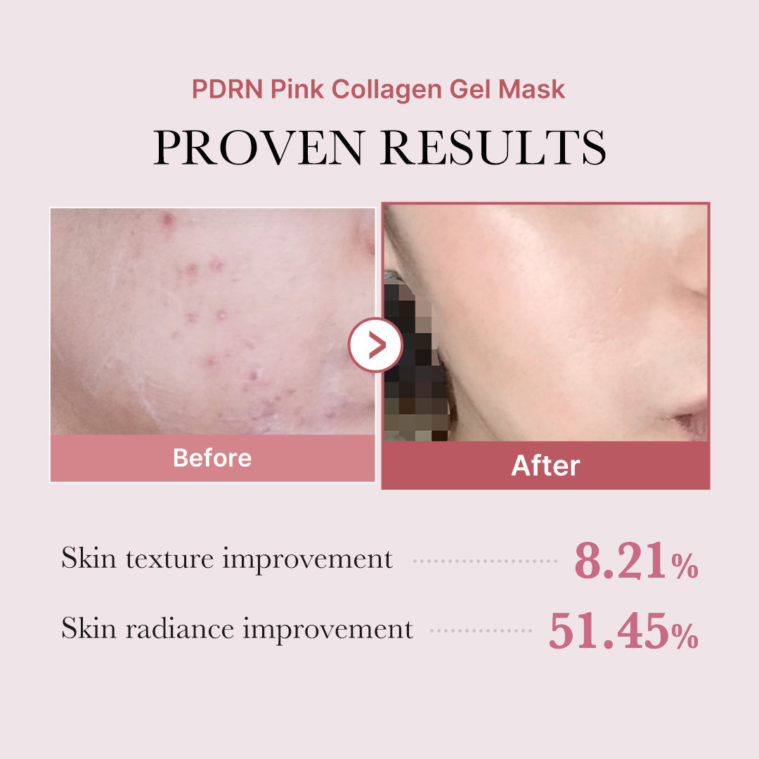 salmon-pdrn-pink-collagen-jelly-gel-mask-z7 PDRN_12.jpg